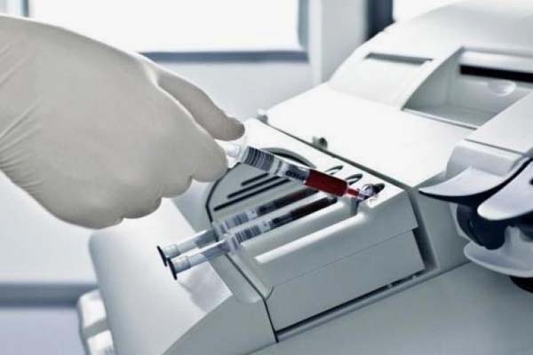 Medical Precision: Stepper Motor Technology in Blood Analyzers